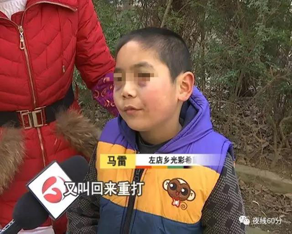 小学生没完成作业被女老师打成熊猫眼 校方:她