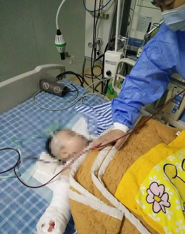 可怕!女婴被医生剪断指 院方：医生停止执业活动3个月等处罚