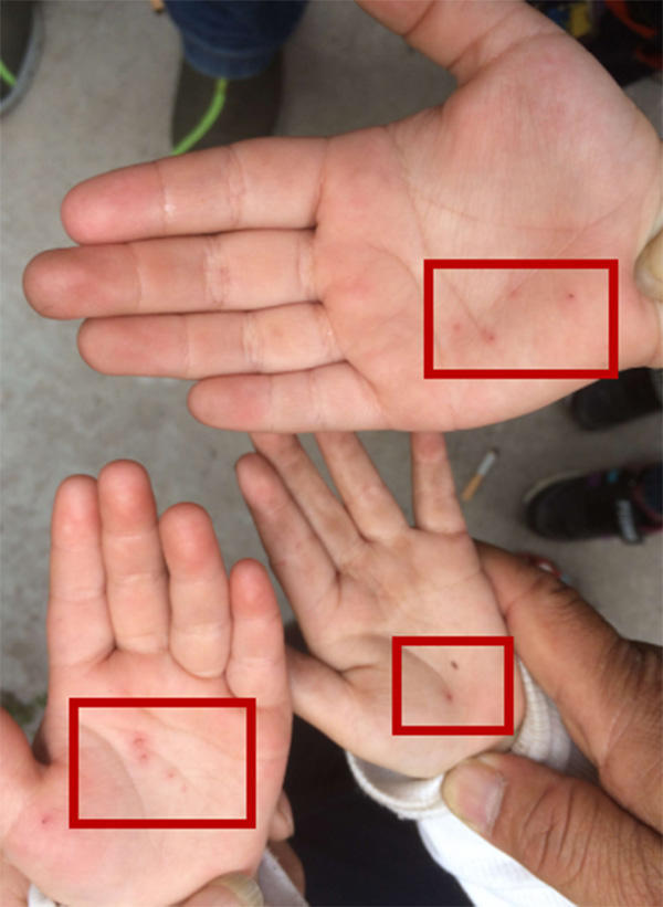 河南针扎幼儿被拘 教育部门对涉事幼儿园下发整改通知书