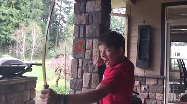 13岁美国少年射箭拔牙 将成长的疼痛掌握在自己手中